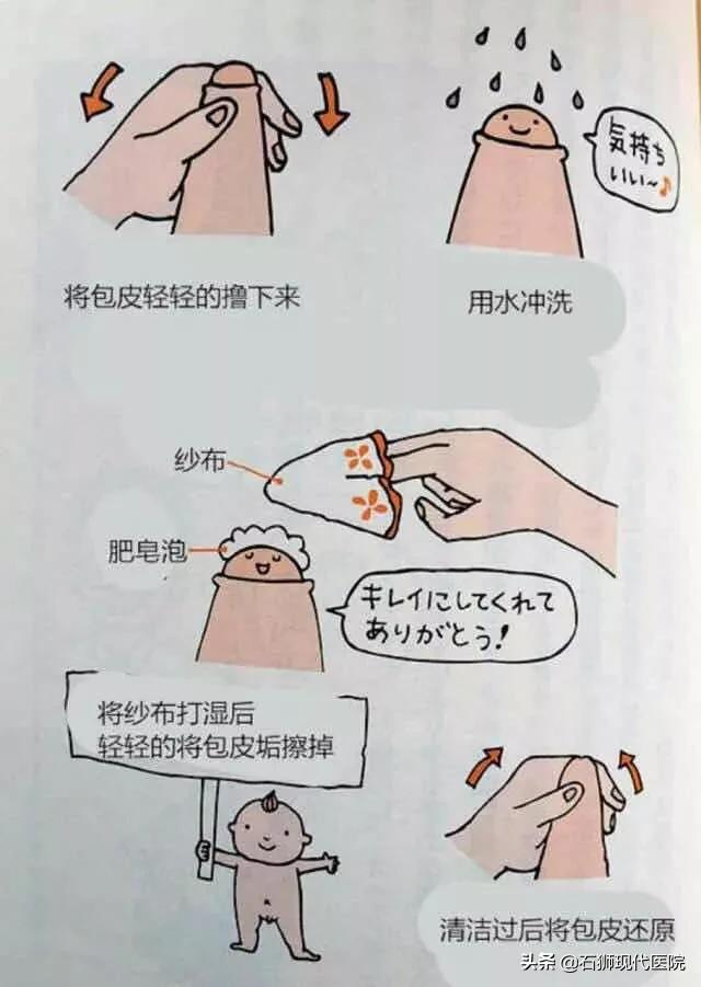 家长们看过来！孩子包皮长不长？割不割？看完你就懂了