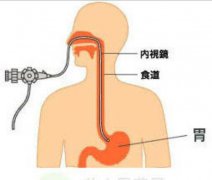 做胃镜要抽血查性病？为什么有的医院