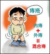 怎么治疗混合痔疮比较好？