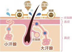 如何杜绝腋臭复发的情况？