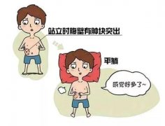 疝气是咋回事？了解藏在身体里的“小