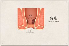 为何痔疮有的疼有的不疼