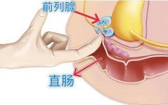 关爱自己从保养前列腺开始！1分钟自测