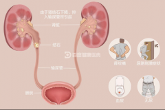 痛！痛！痛！常见急腹症之——输尿管